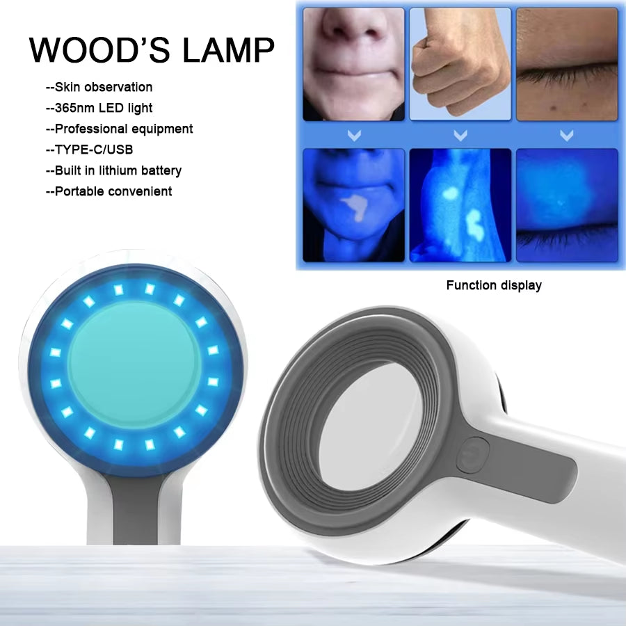 NEW Woods Lamp Skin Analyzer for Skin UV Magnifying for Beauty Facial Testing Wood Lamp Light Skin Analysis Detection Skin Care