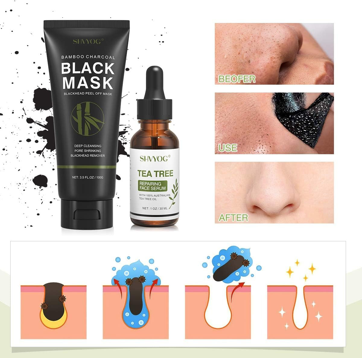 Masque De Points Noirs Masque Peel off Blackhead Remover Au Charbon Dissolvant Les Points Noirs Avec Sérum Arbre À Thé, Nettoyage En Profondeur Purifiant, Acné, Rétrécissement Des Pores(100G+30Ml)